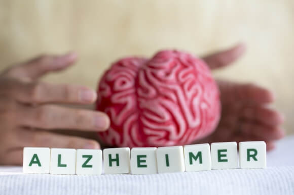 Maladie d'Alzheimer : les dernières avancées, pour quels traitements ?