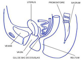 incontinence prolapsus