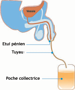 incontinence système collecteur