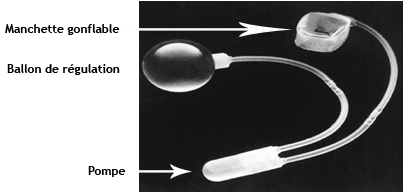 sphincter artificiel